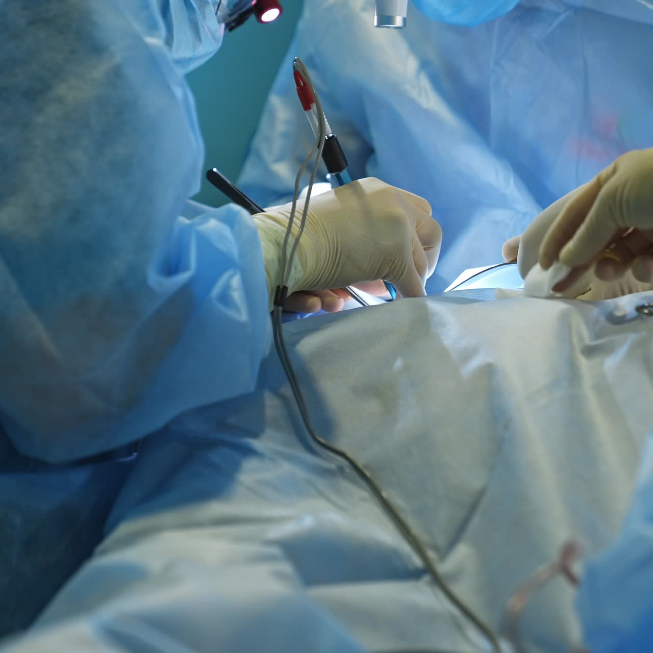 Two unrecognized surgeons in latex gloves performing operation using electric device. Nurse's hand puts the instruments and bands on the patient closer to doctors
