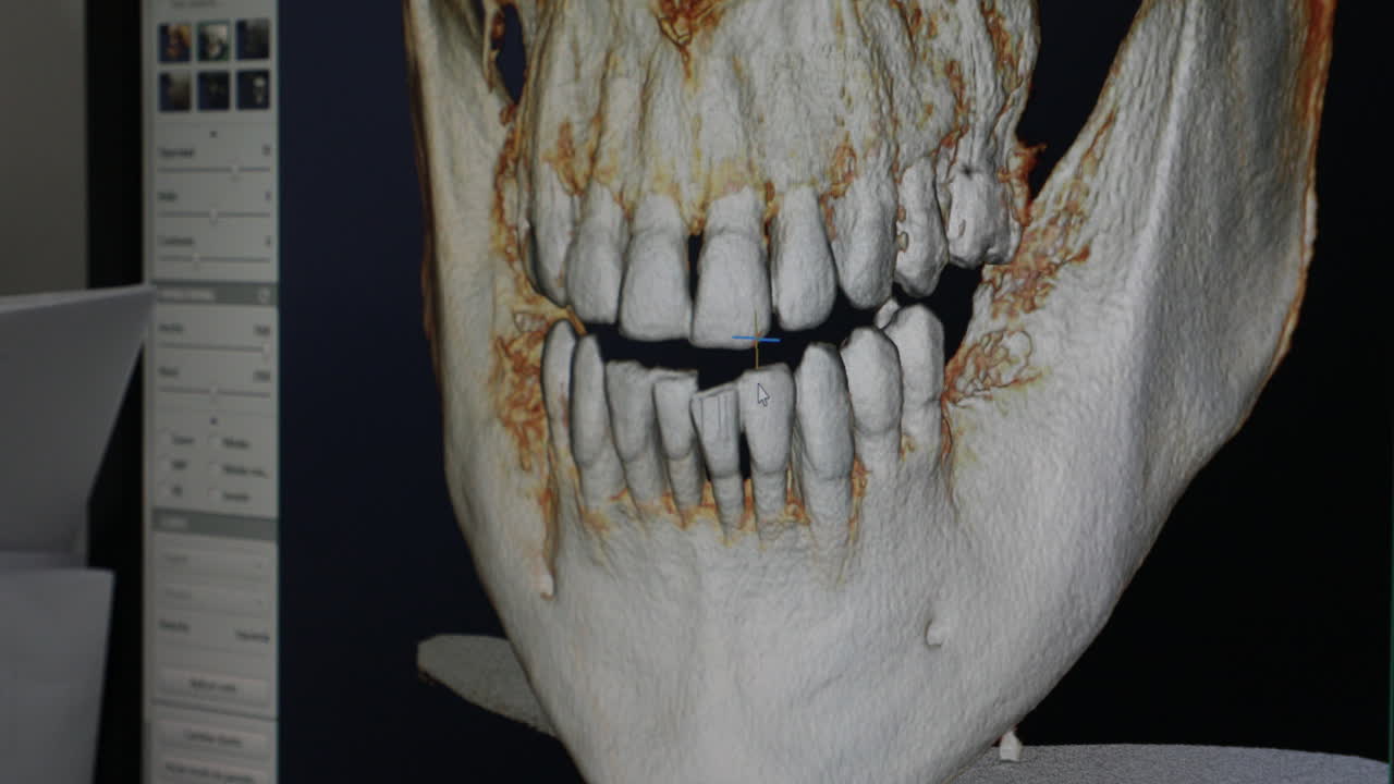 작물 치과의사가 화면에서  ⁇ 의  ⁇ 스레이를 검사하고 있습니다.