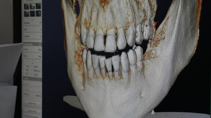 Crop dentist examining x ray of jaws on screen