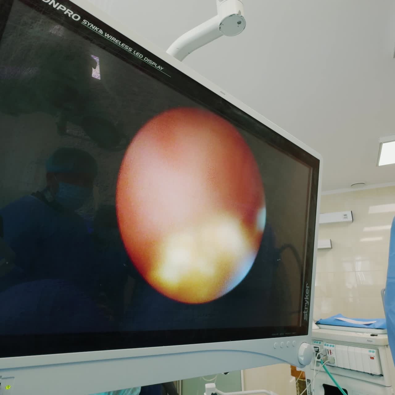 Un medico concentrato guarda il monitor che mostra il processo chirurgico. Un chirurgo si trova vicino al paziente coperto con un telo blu