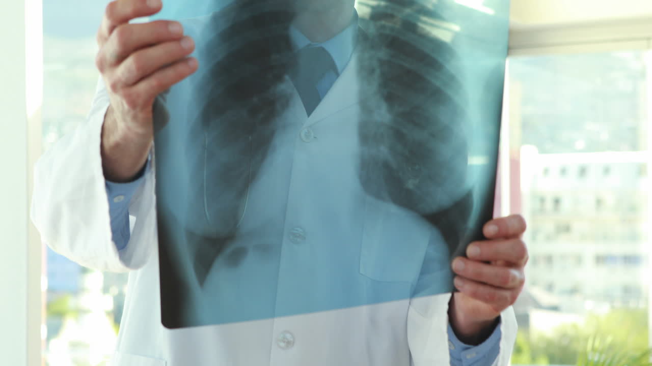 un médico serio mirando las radiografías