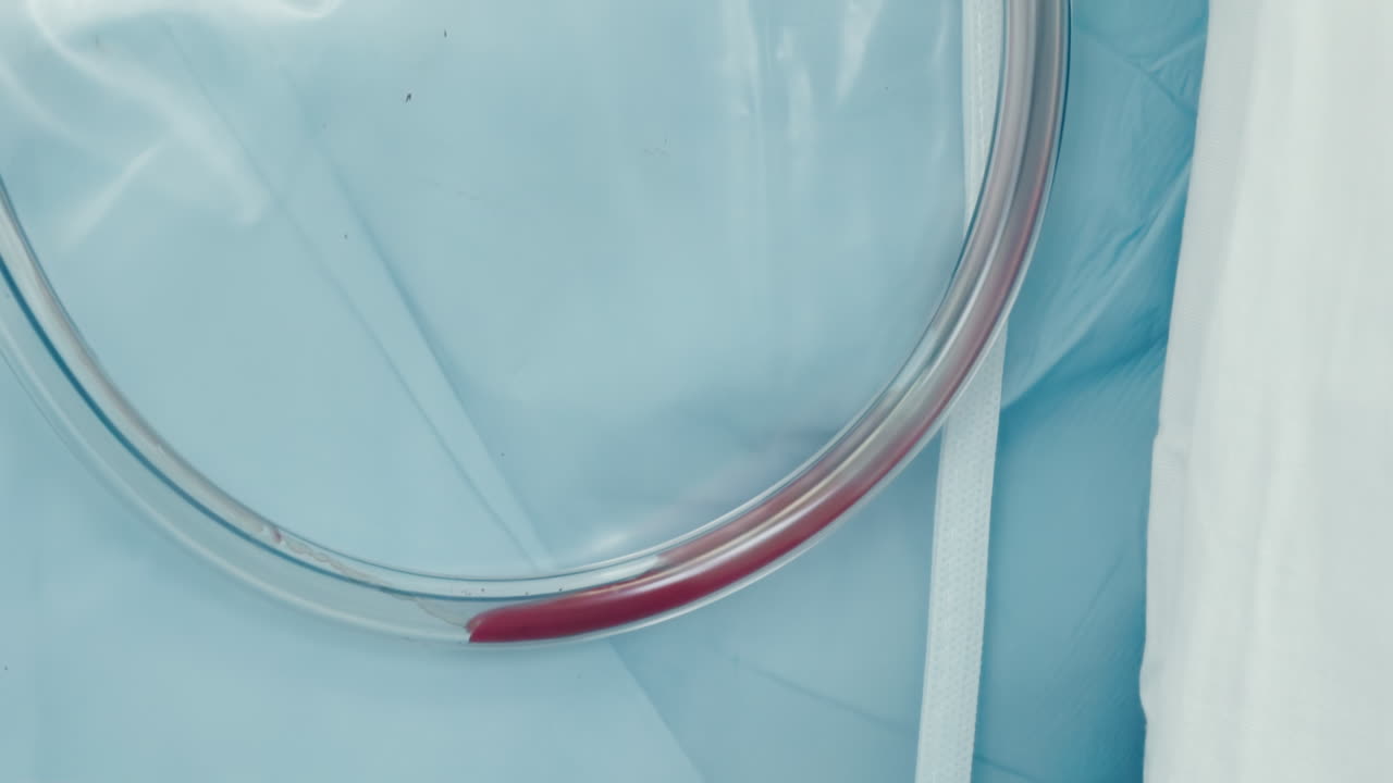 tubo de derivación cardiopulmonar con sangre. equipo médico vital se hace cargo de la función de circulación del corazón y oxigenar la sangre durante la cirugía