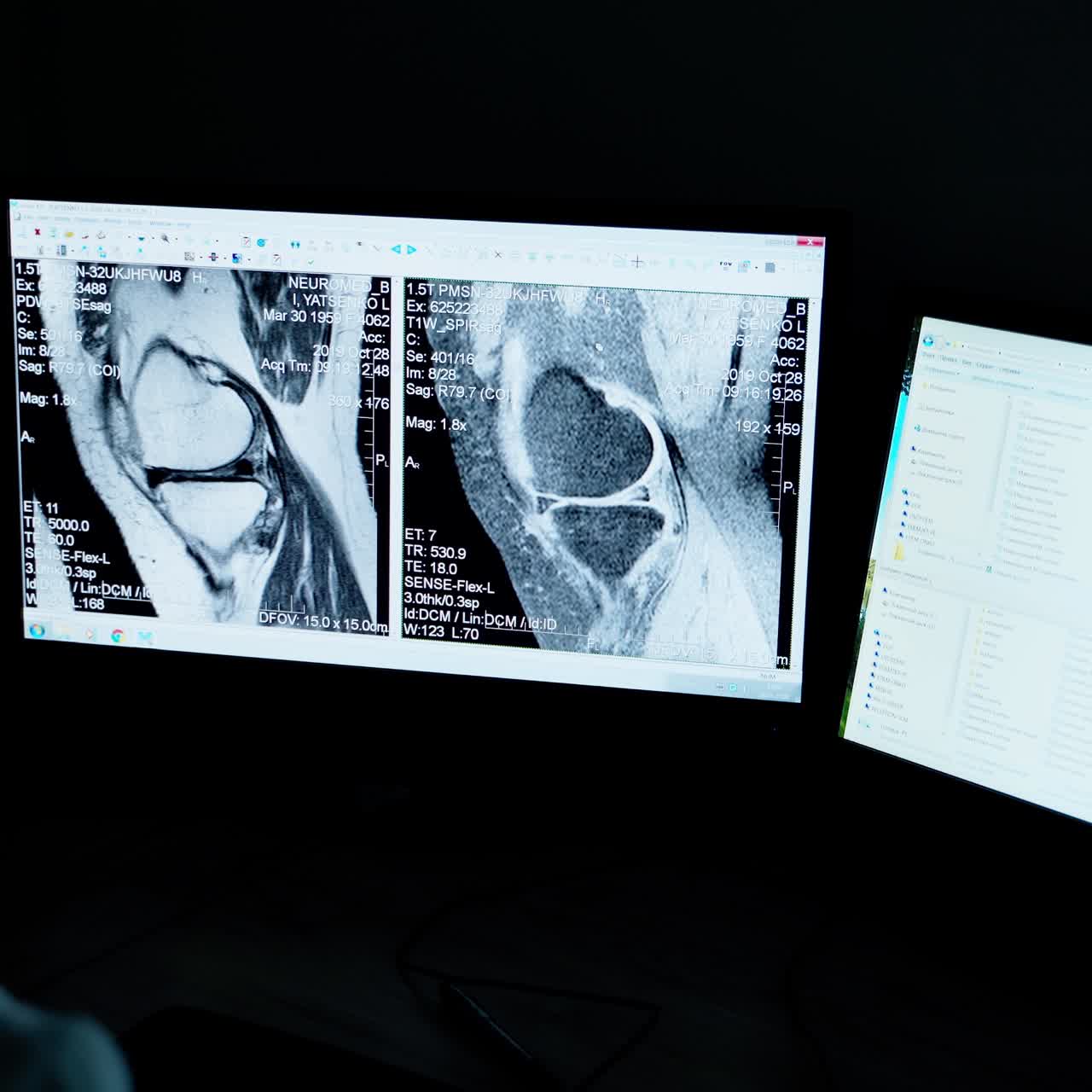 Magnetic resonance image
