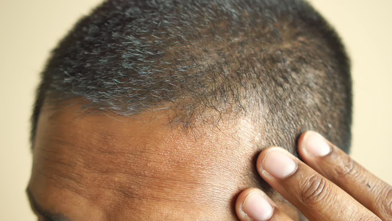 사람의 머리와 손이 이마를 만지는 클로즈업