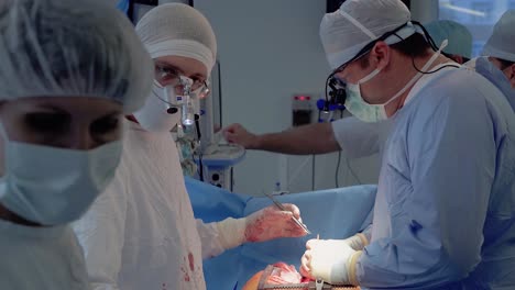 medical staff of the operating unit do heart surgery nurse assists in performing the operation