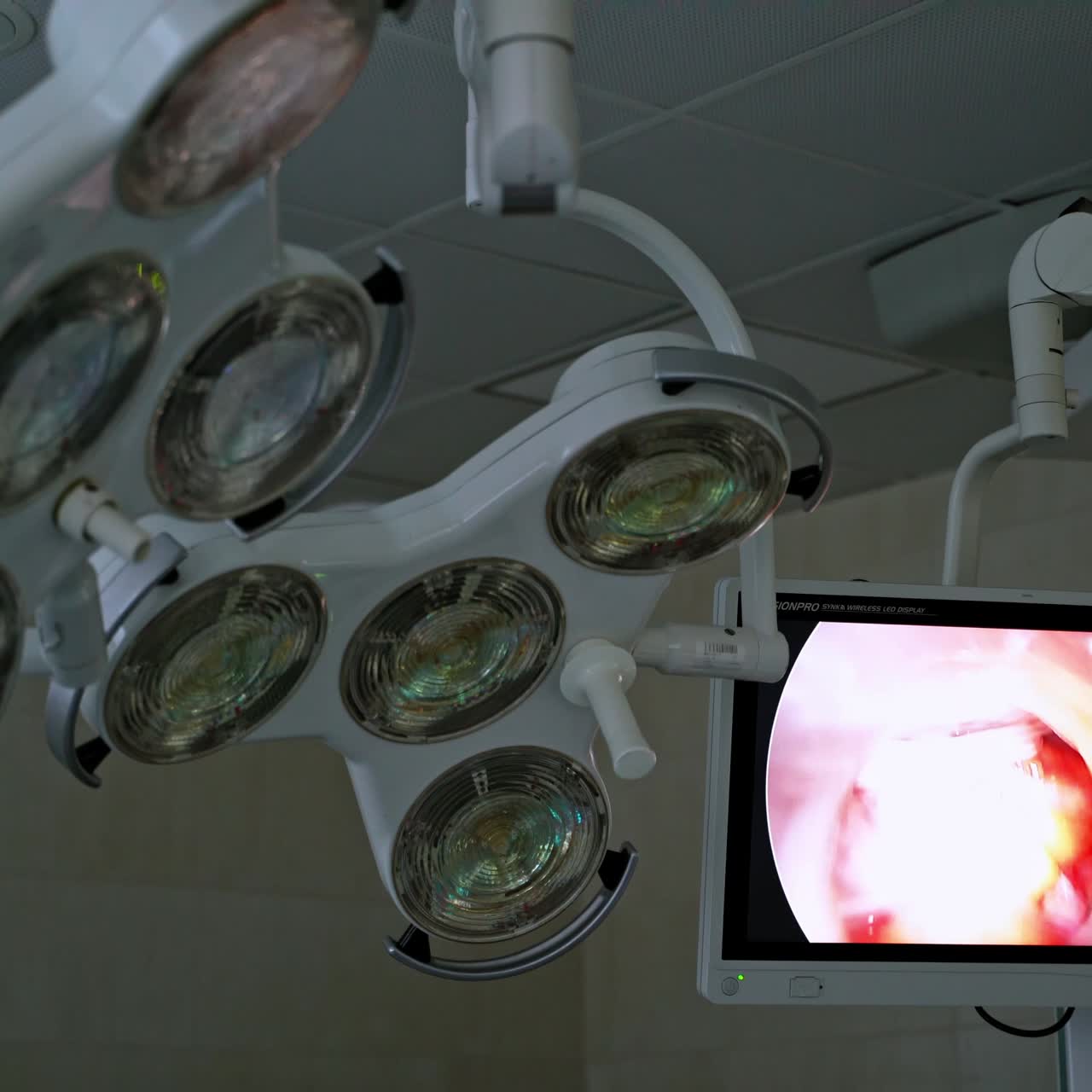 Lámparas quirúrgicas en quirófano.
