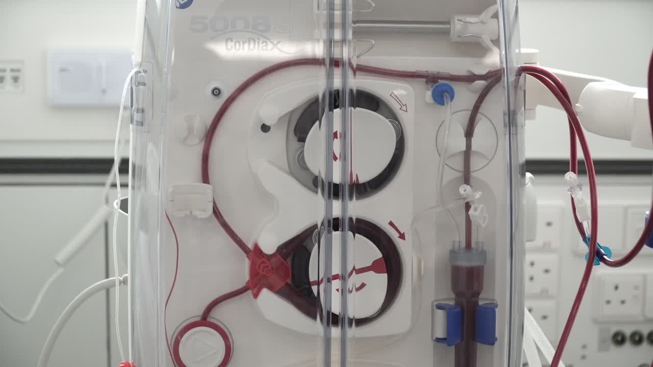 primer plano de una máquina de diálisis de sangre que bombea para filtrar la sangre