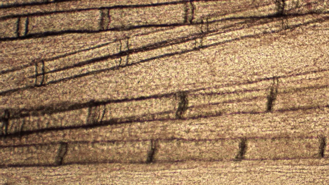 vasos sanguíneos que transportan células sanguíneas, como se ve a través de un microscopio