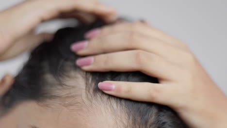 indian woman showing her receding hairline in white background.