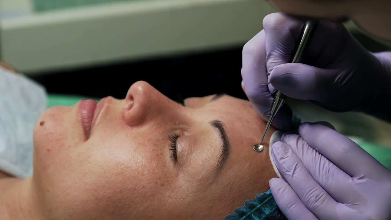 Careful cosmetologist uses the tool to remove blackheads from the female client's skin. Face care and beauty concept. Close up.