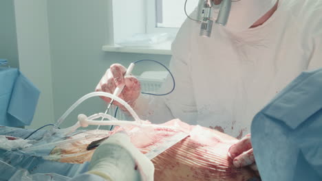 surgeon uses electrocautery device. doctor in binoculars manages equipment for coagulation of blood vessels to control and stop bleeding after surgery