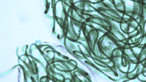 microscopic view of sacks or bubbles containing chains of blue green algae 3