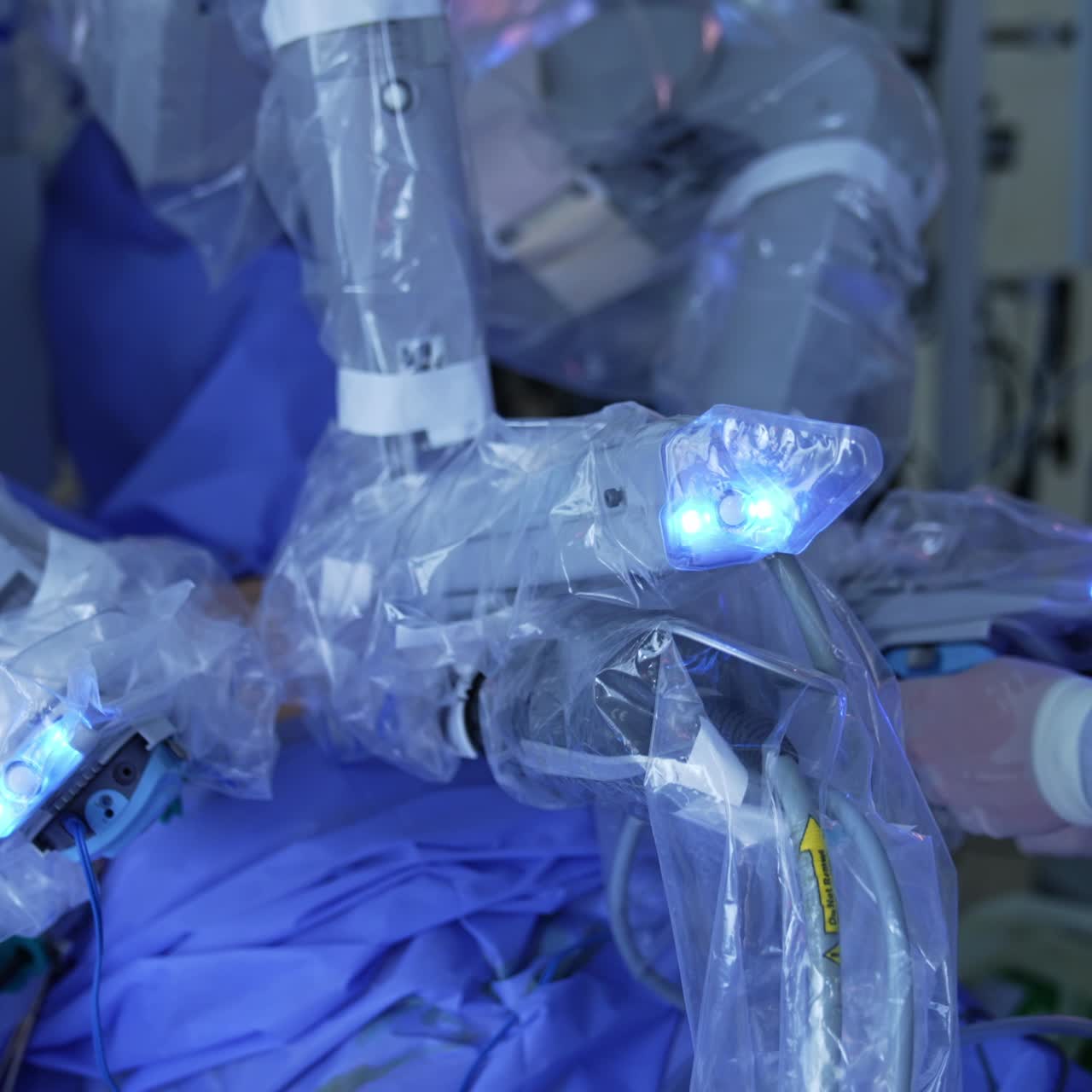 Contemporary operation with the help of robotic equipment. Experienced doctor standing nearby holding an instrument input into patient's body