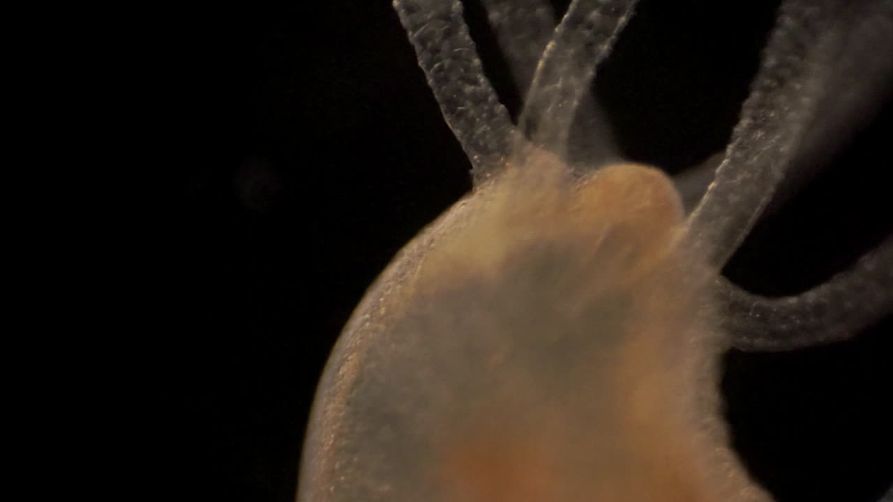 imágenes microscópicas de hidra