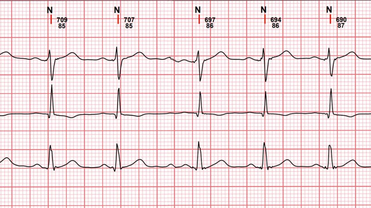Electrocardiogram ECG with heart line curves medical examination