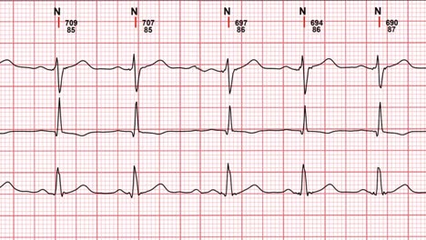 electrocardiogram ecg with heart line curves medical examination
