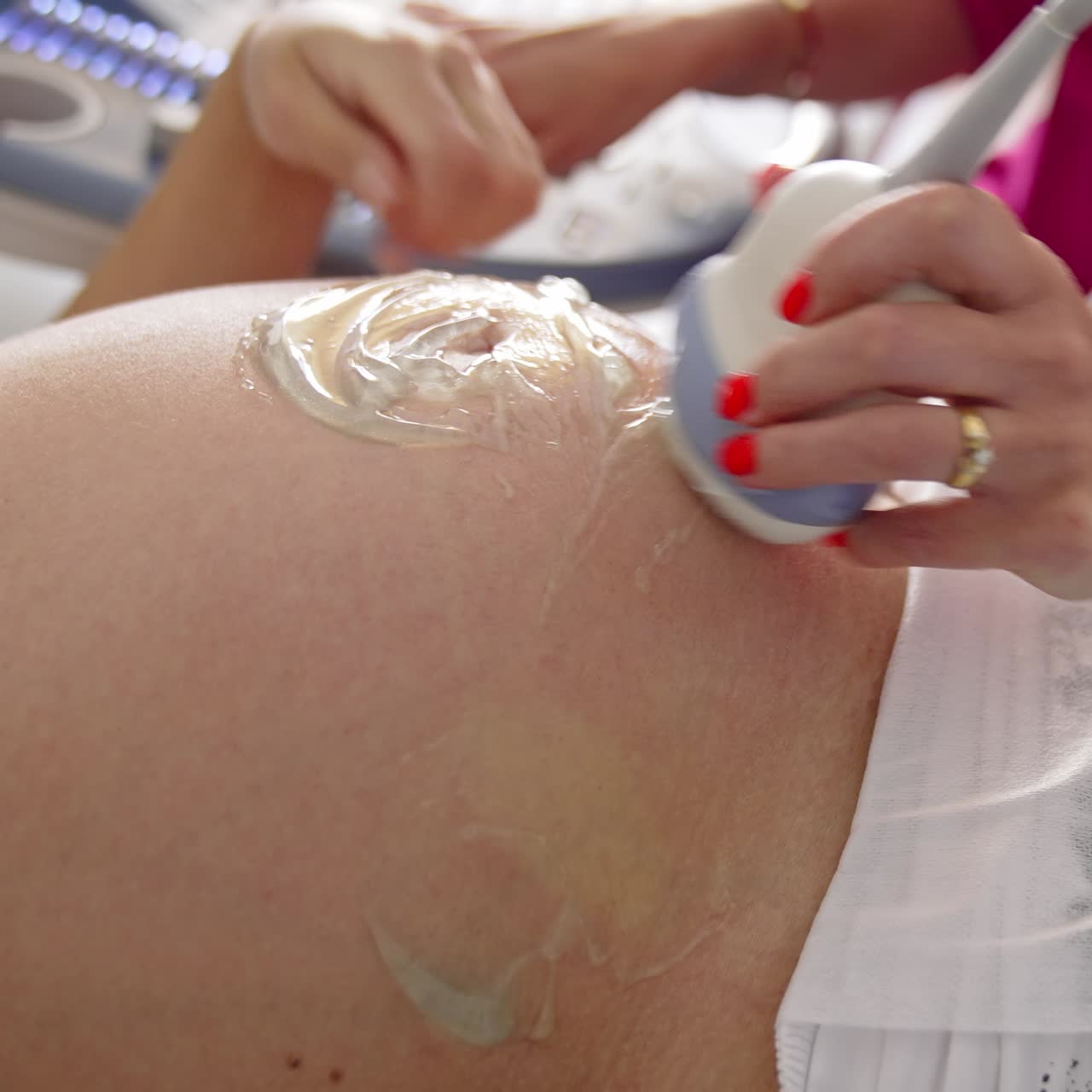 Sonogram procedure to a pregnant woman. Doctor doing ultrasound in the hospital. Pregnancy and healthcare concept. Close-up