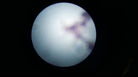 centrándose en microscopio en microbios