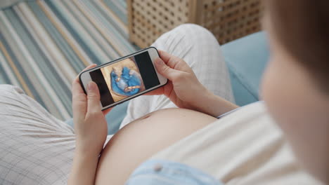 pregnant woman viewing ultrasound image on mobile phone