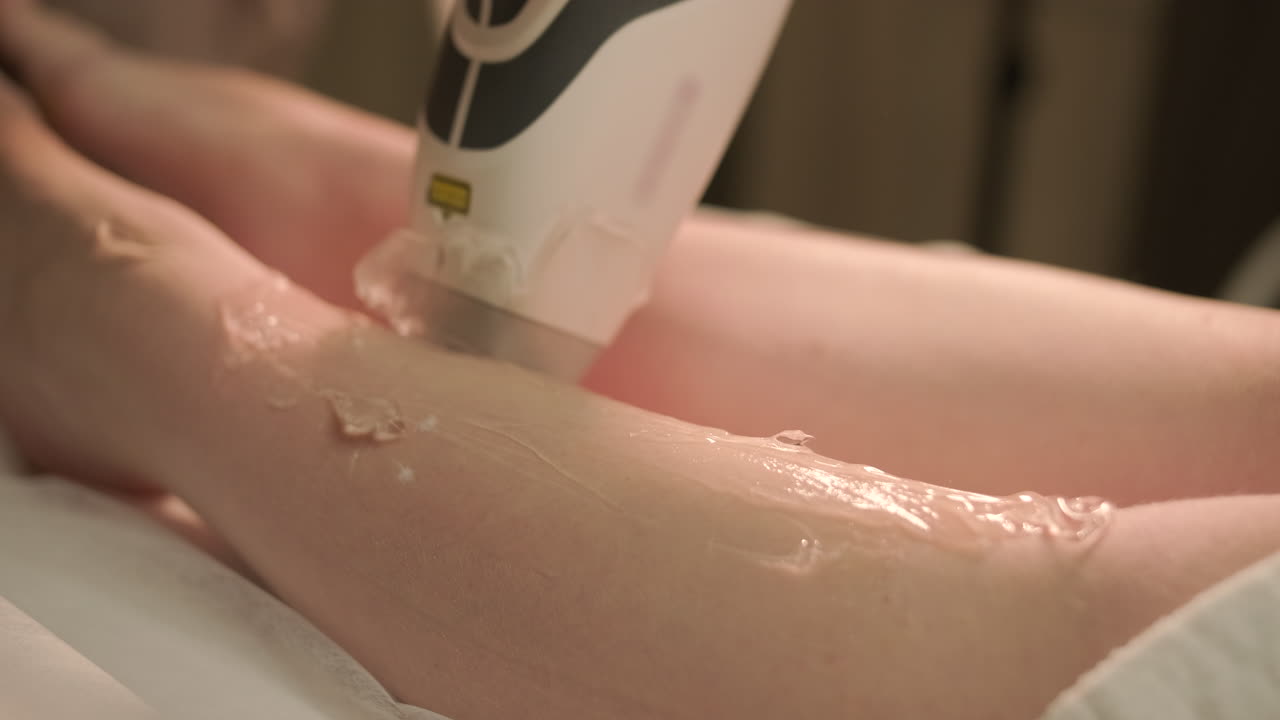 Close-Up of Laser Hair Removal Treatment on Leg