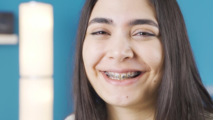Giovane donna felice che sorride. Apparecchio dentale.