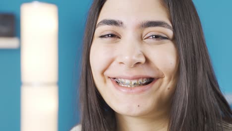 Mujer-Joven-Feliz-Sonriendo.-Brackets-Dentales.