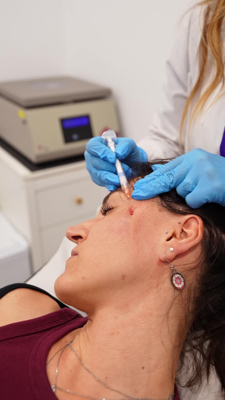 Procedura cosmetica filler dermici