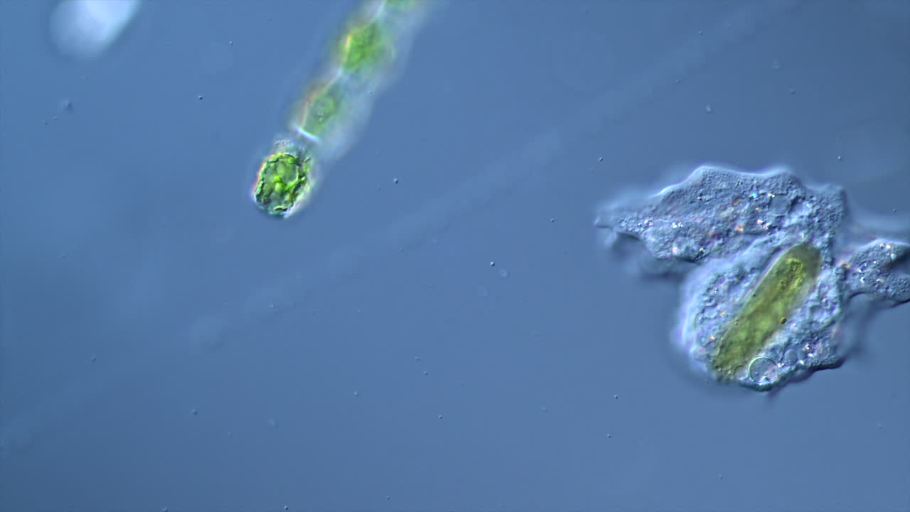 Microscopic view of aquatic microorganisms, including an amoeba and a ciliate-like organism