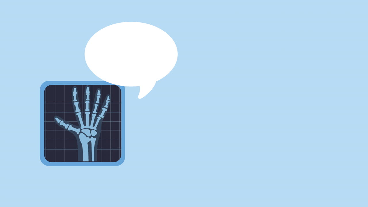 escaneo de hueso de la mano rx animación médica