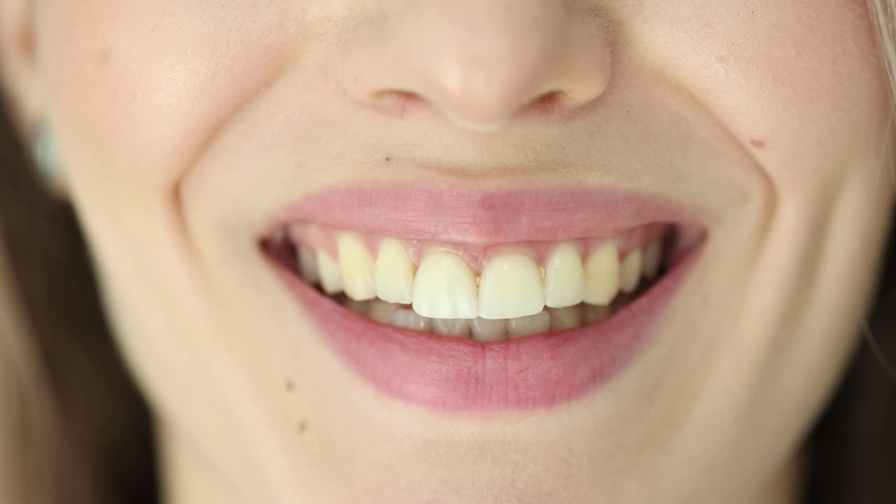 A smiling woman showing her teeth
