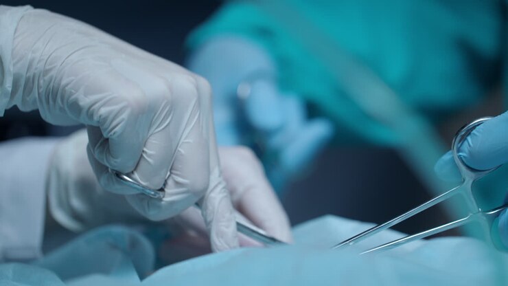 Surgery hands performing operation. Surgery hands at medical operation