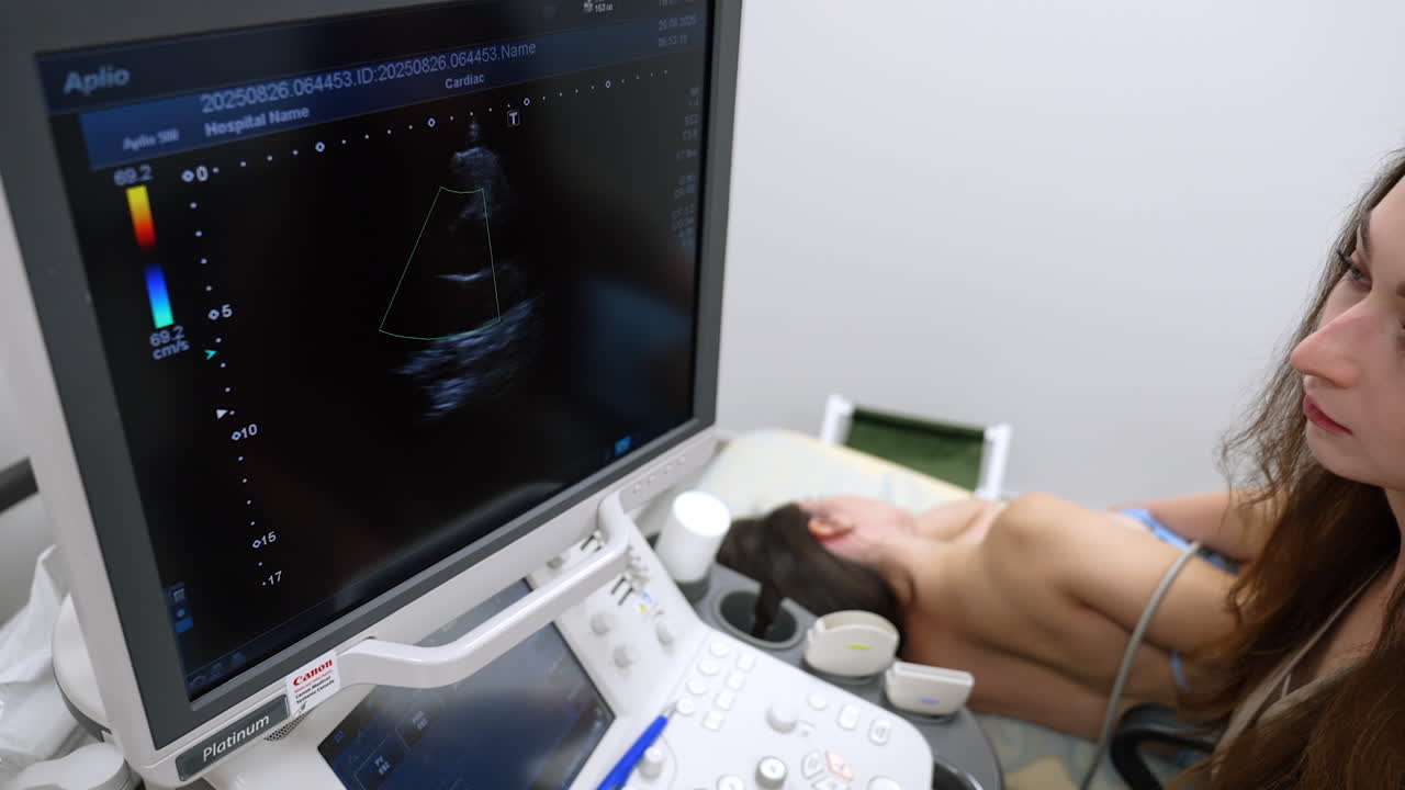 Kyiv, Oekraïne, 2 augustus 2025: kleuren-Doppler hart-echografie. Close-up van cardiale echografiemonitor met kleuren-Doppler-afbeelding tijdens controle van de hartfunctie