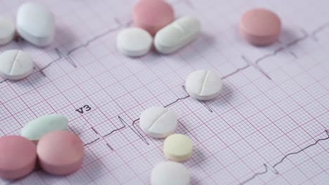 ecg with medications