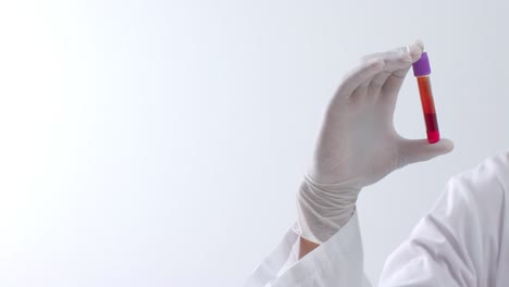 hand wearing medical glove holding blood sample on white background with copy space, slow motion