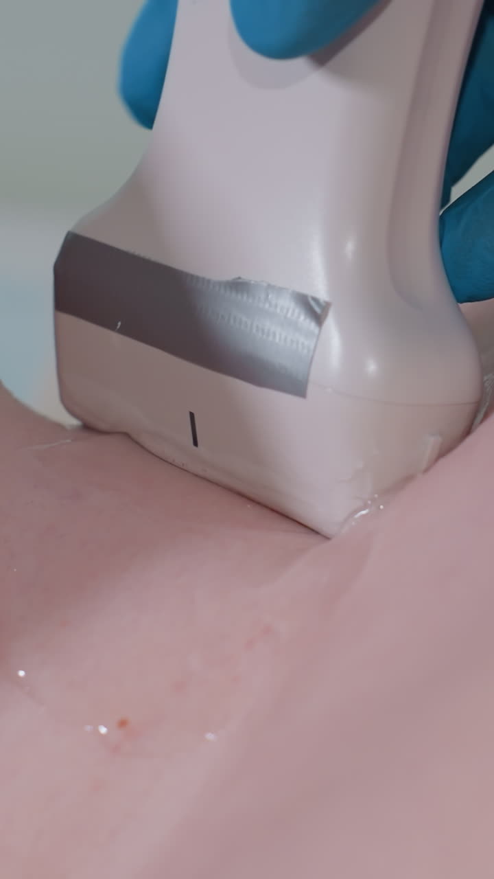 ultrasound probe on neck vein emergency clinician uses transducer with gel to locate vessel for central access, sterile gloved hand steadies probe, Doppler flow assessment and lumen visualization