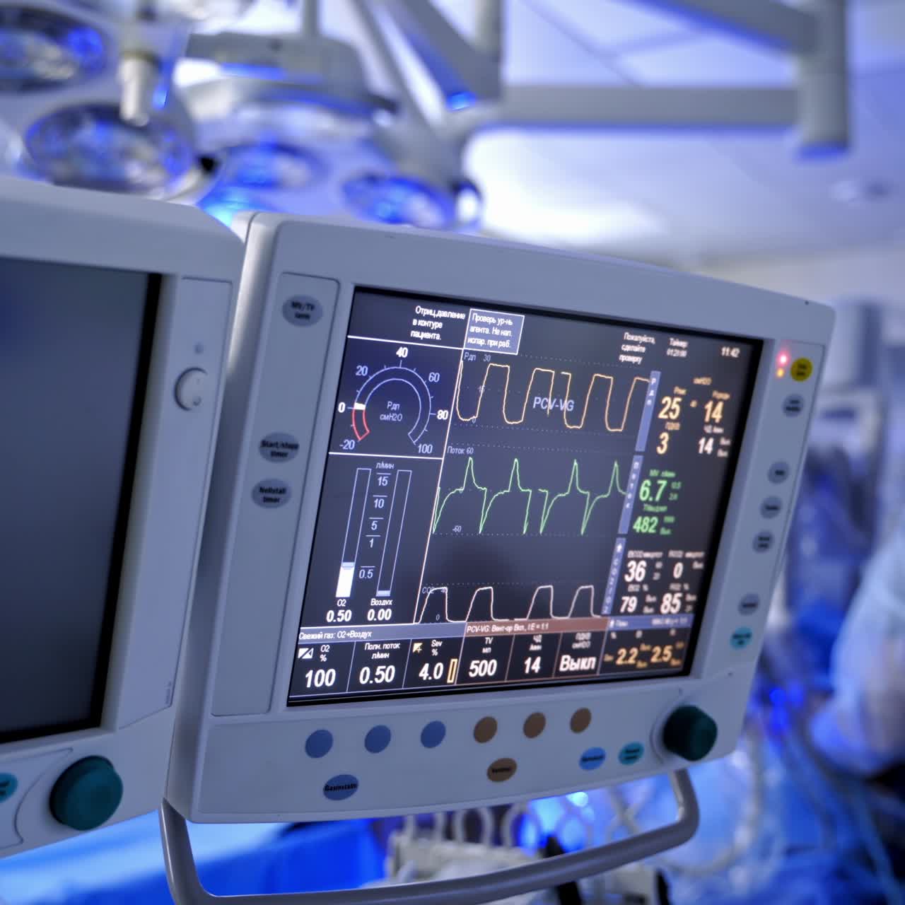 Graphs on screen during surgical process. Anesthesia surgery monitor. Medical vital signs of a patient on monitor. Patient's heartbeat on the medical display.