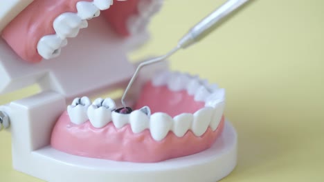 modelo dental con instrumento dental