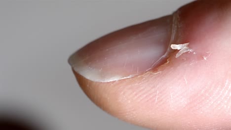 hangnail on finger close up - damaged cuticle detail shot