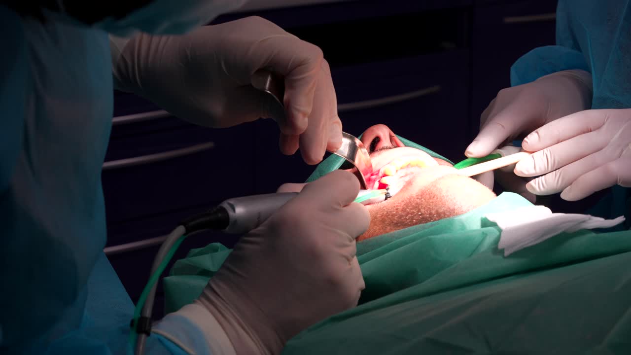 el dentista atornilla el implante dental con herramientas de precisión, utilizando un espejo y un destornillador