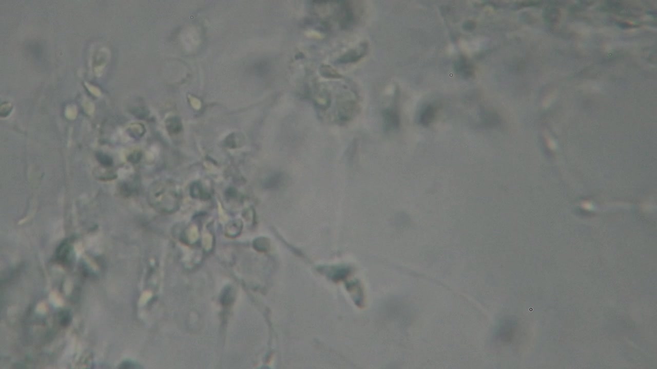 Microscopic view of moving human sperm cells with visible heads and flagella against a light background, commonly used in fertility and reproductive studies