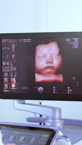 3d ultrasound image of a fetus displayed on a medical monitor in a clinical environment