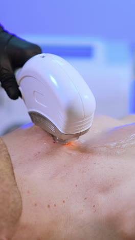 hair removal procedure with the help of elos epilation. cosmetologist moves the equipment by the make chest. vertical video