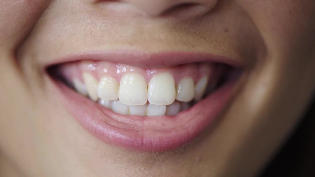 Close-up of a Young Woman Smiling and Showing Her Teeth