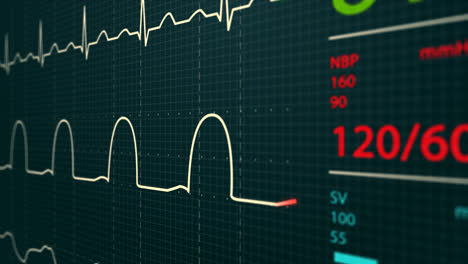 Animation-of-schematic-Intensive-Care-Unit-monitor-showing-normal-values-for-vital-signs,-starting-with-cardiac-frequency.-Dark-blue-backgound.-Perfect-for-any-medical-related-purposes.