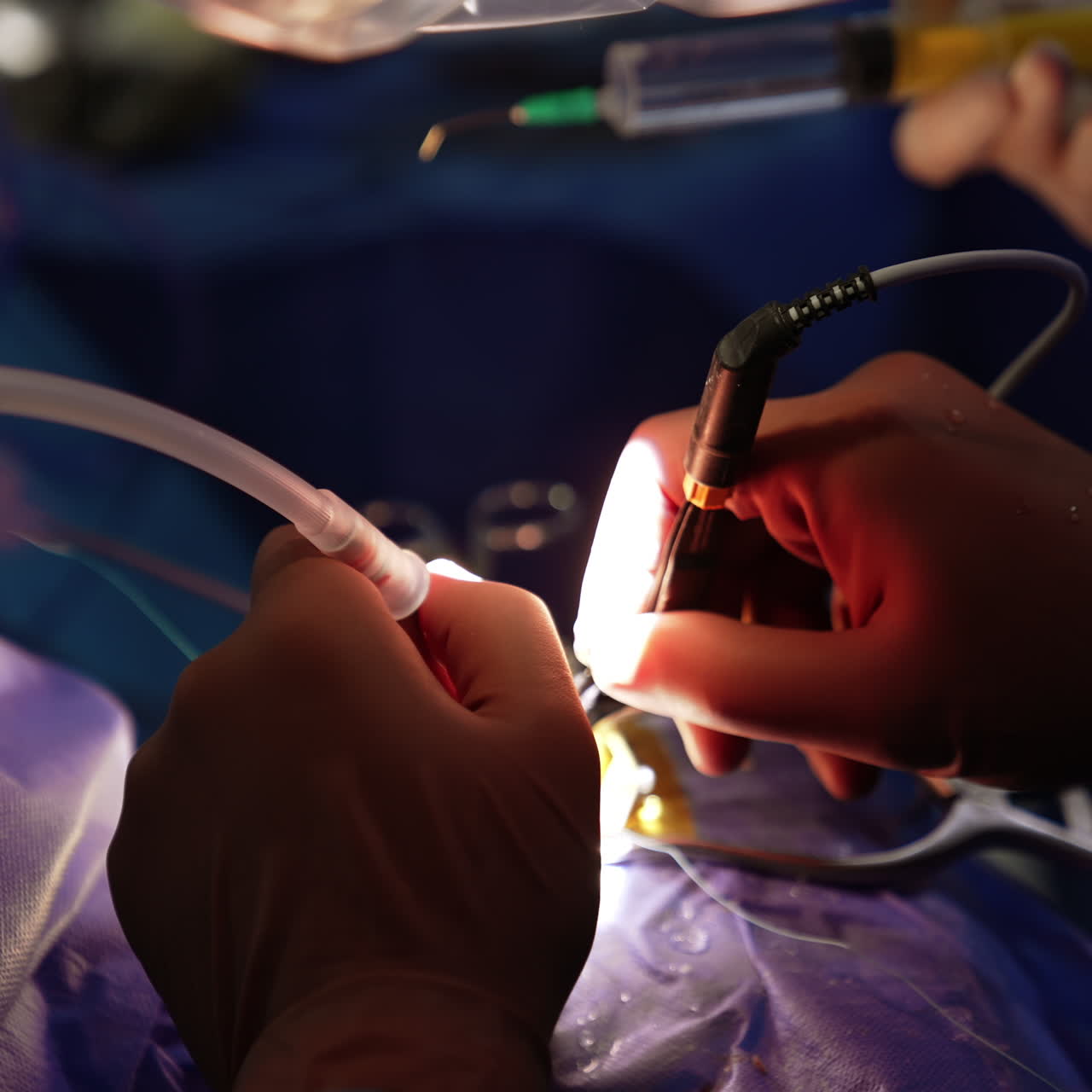Unrecognized surgeon's hands hold device tools. Hand of assistant pouring the liquid from the syringe. Close up.