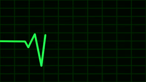 electrocardiograma (ecg o ecg) de bucle verde