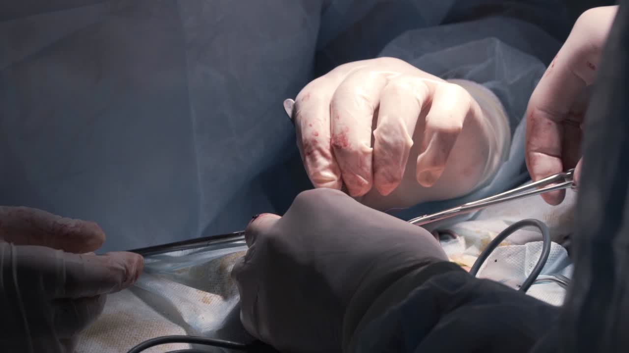 진행 중인 수술 절차