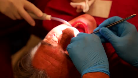 close-up of a patient undergoing a dental procedure