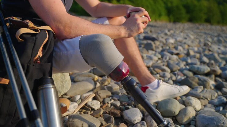 Person with a prosthetic leg resting by a river