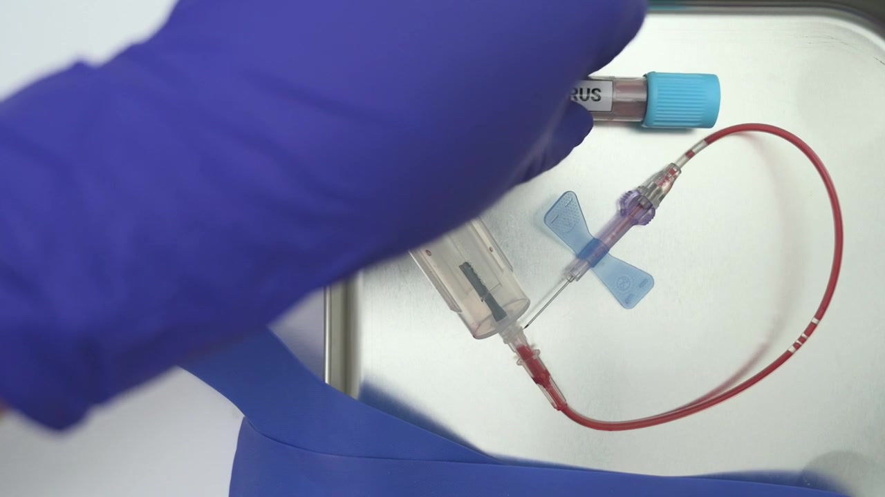 Professionista medico che preleva una provetta di sangue per Hantavirus su sfondo bianco.